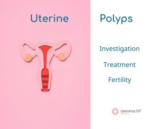 Uterine Polyps