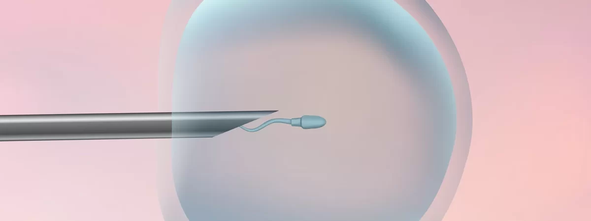 Μικρο-Γονιμοποίηση (ICSI)