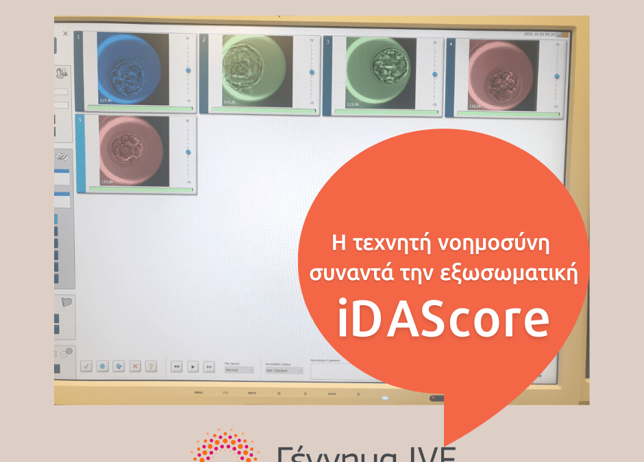 IDAScore