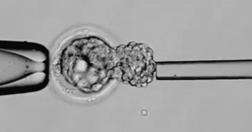 Προεμφυτευτικός Γενετικός Έλεγχος – ή “PGT”.